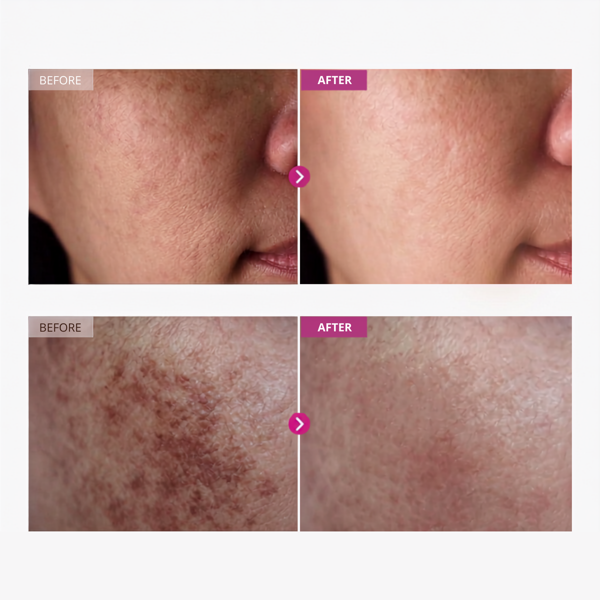Helm Corrector Cream