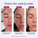 Helm Corrector Cream