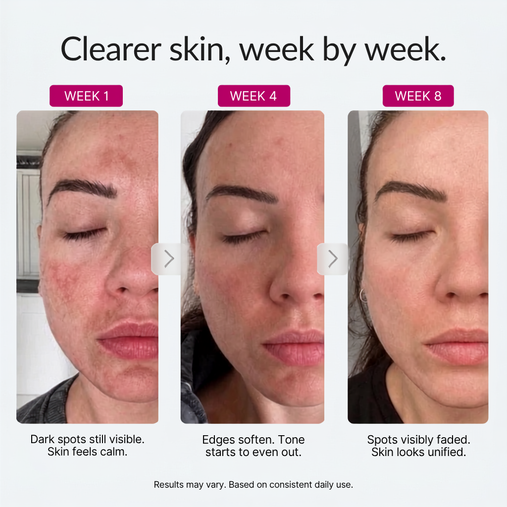 Helm Corrector Cream