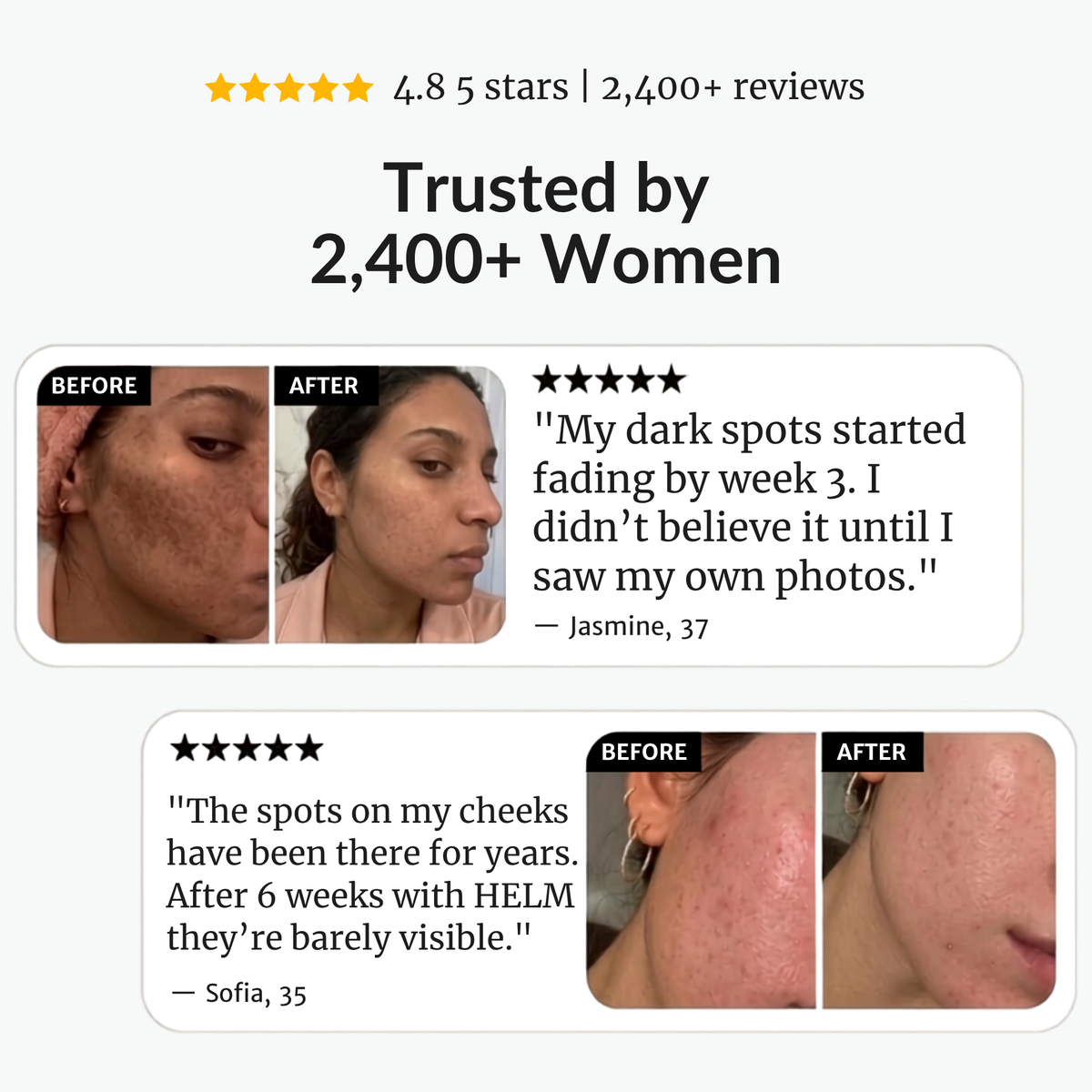 Helm Corrector Cream