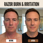 Post-shave repair balm