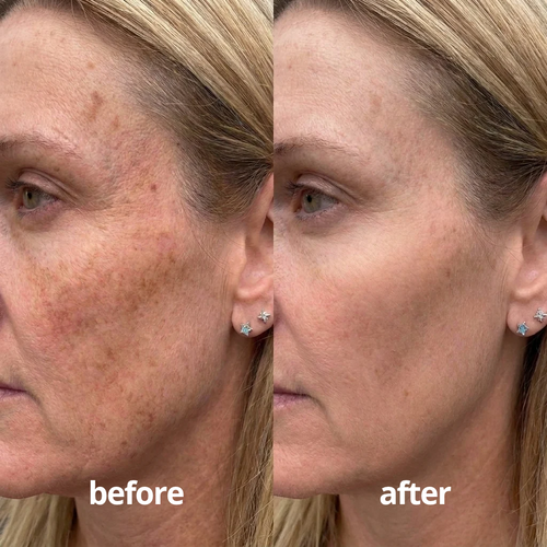 Helm Corrector Serum