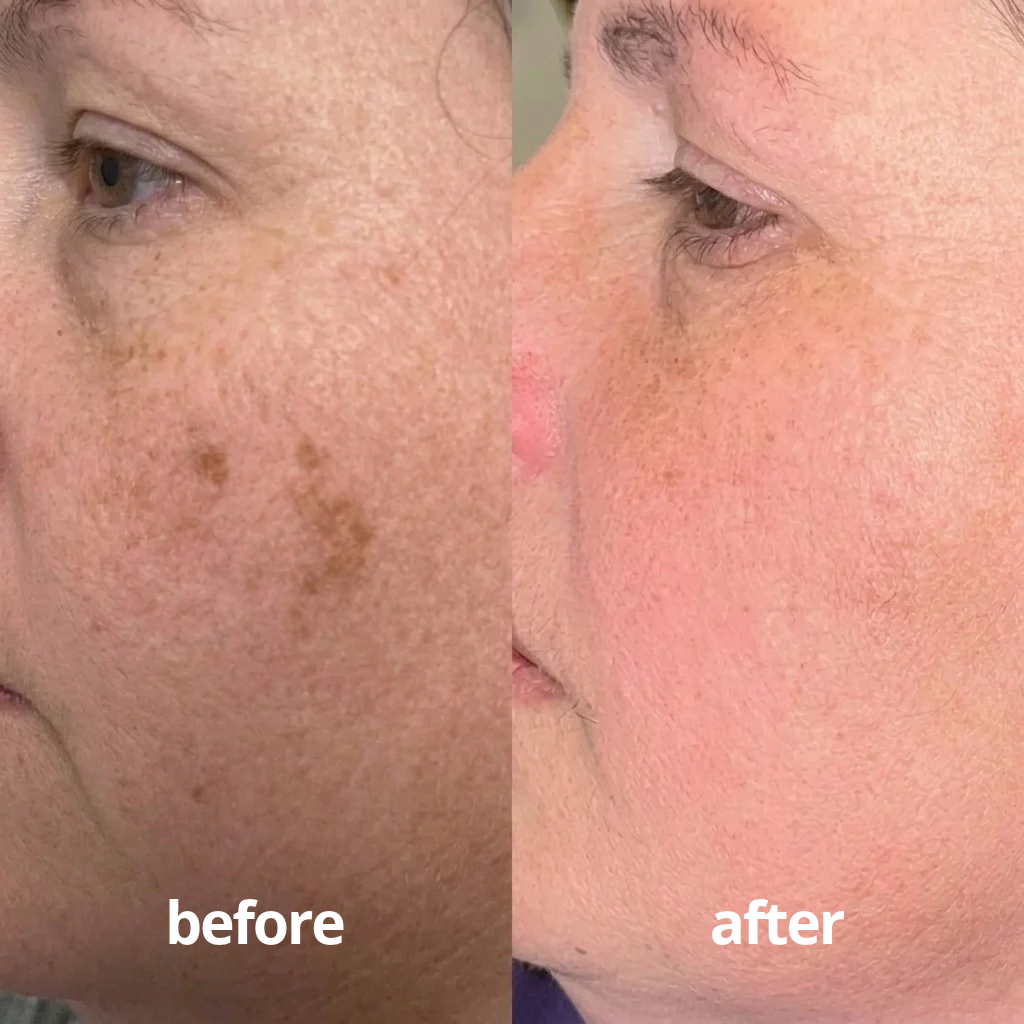 Helm Corrector Serum
